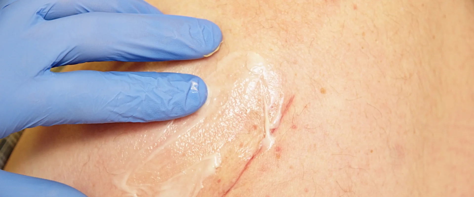 Nighttime Skin Repair Tips: How to Heal Cuts Faster Overnight