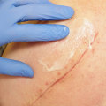 Nighttime Skin Repair Tips: How to Heal Cuts Faster Overnight