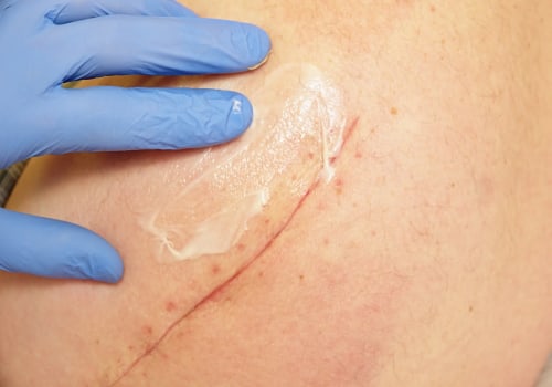 Nighttime Skin Repair Tips: How to Heal Cuts Faster Overnight